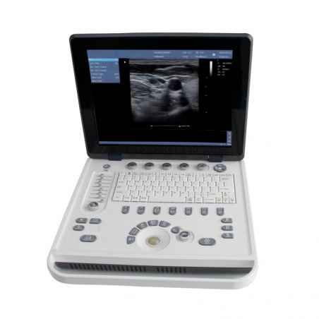 Wireless Ultrasound Machine