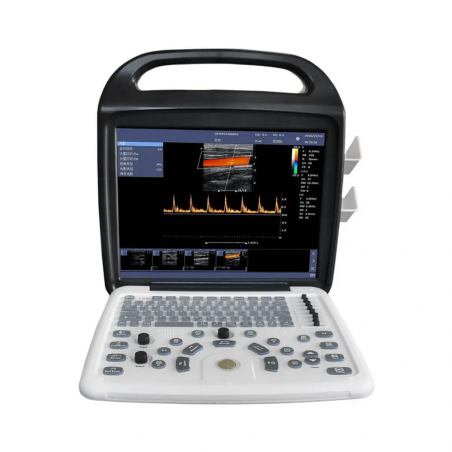 Yonker Portable Ultrasound Machine